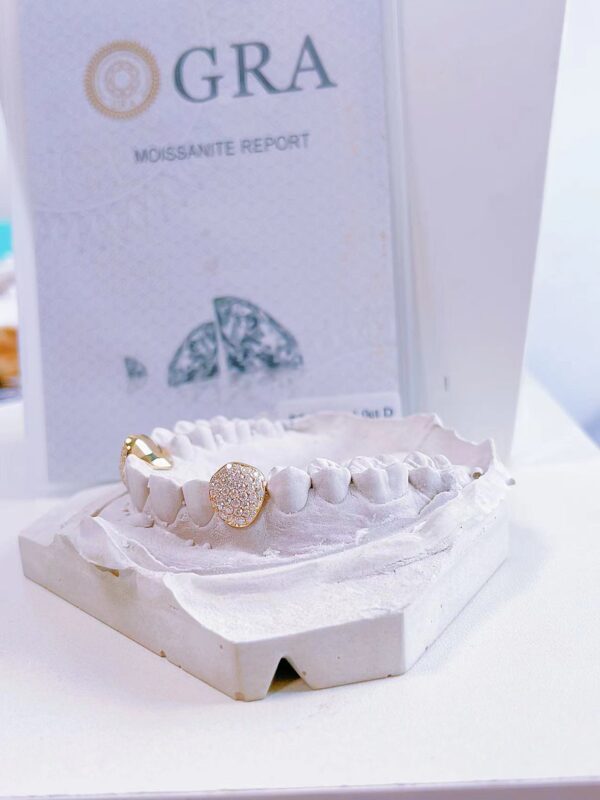 Custom Sterling Silver Canine Grillz - Image 2