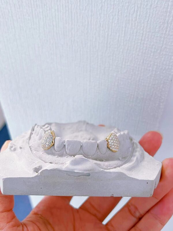 Custom Sterling Silver Canine Grillz - Image 5