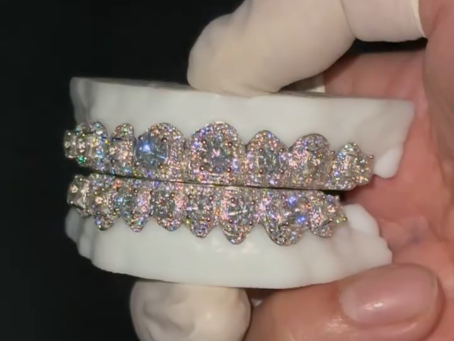custom Grillz in vvs Moissanite