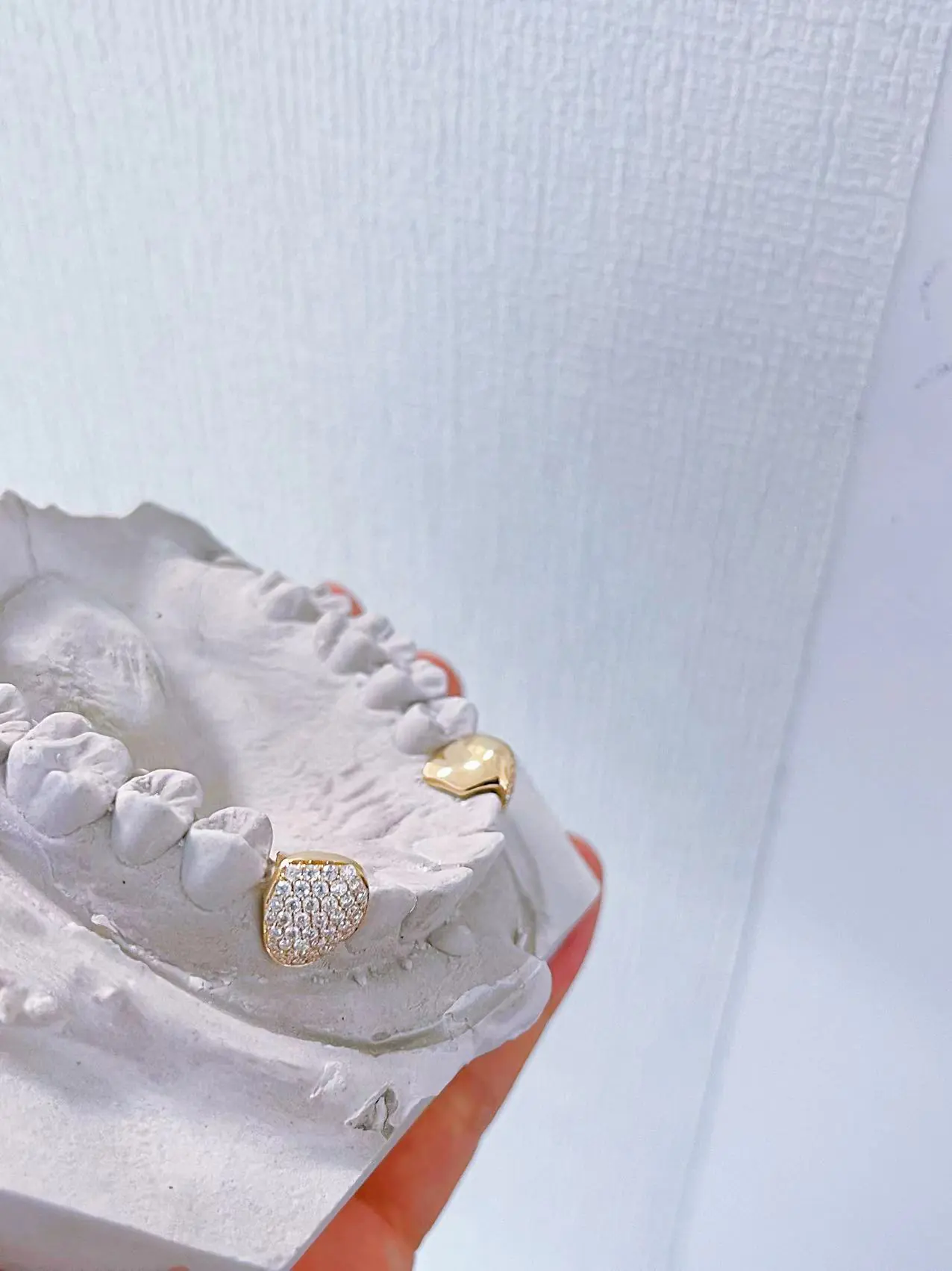 Canine Grillz (3) - Custom & Personalized Jewelry: Unique Designs Crafted Just for You