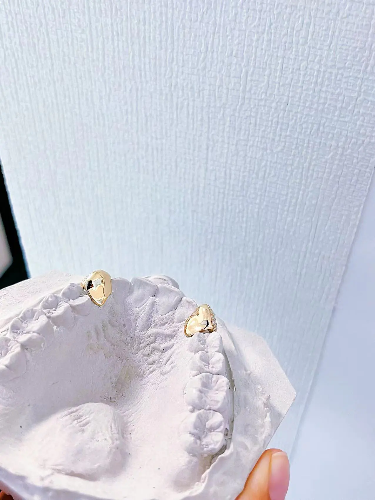 Canine Grillz (7) - Custom & Personalized Jewelry: Unique Designs Crafted Just for You