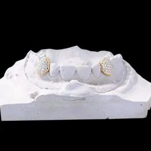 Custom Single Canine Grillz – 2 Bottom Teeth, VVS Moissanite