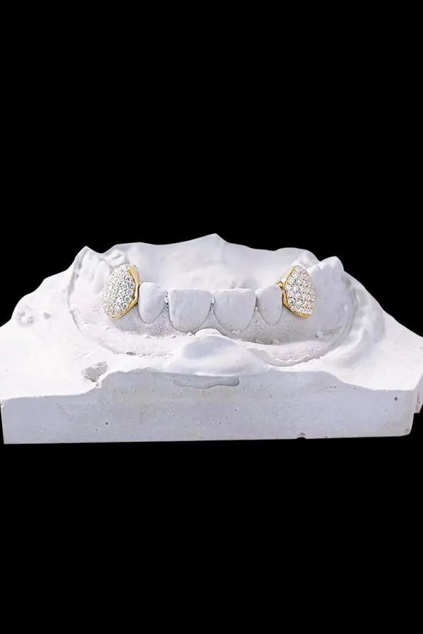 Custom Single Canine Grillz – 2 Bottom Teeth, VVS Moissanite