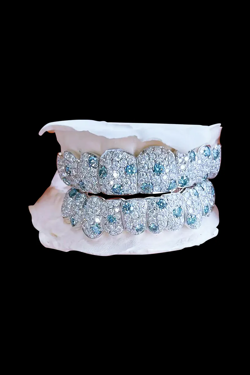 Blue White Moissanite Grillz – 6 Top & Bottom, Handmade Fit